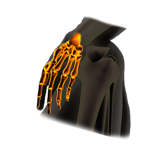 Hand - Finger Probleme Behandlungen Therapie Hand - Finger Probleme Behandlungen Therapie